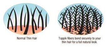 Hair-powder-camouflaging-tricks-face-value-hair-transplant-clinic-in mumbai-india-1